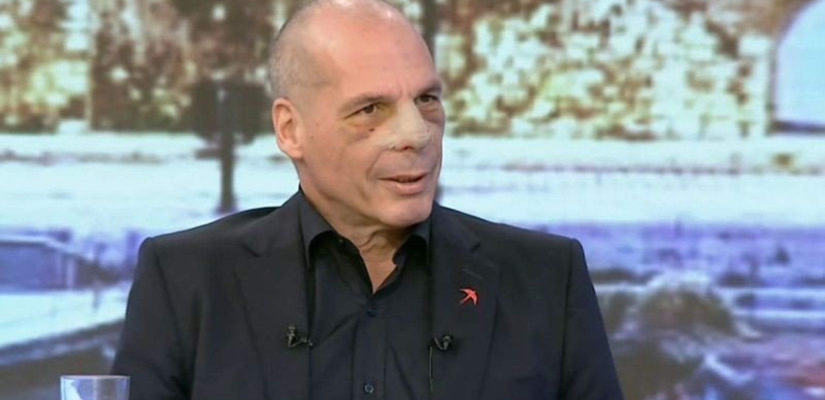 Βαρουφάκης: Η πρώτη εμφάνιση μετά την επίθεση στα Εξάρχεια - Τα εμφανή σημάδια στο πρόσωπο (βίντεο)
