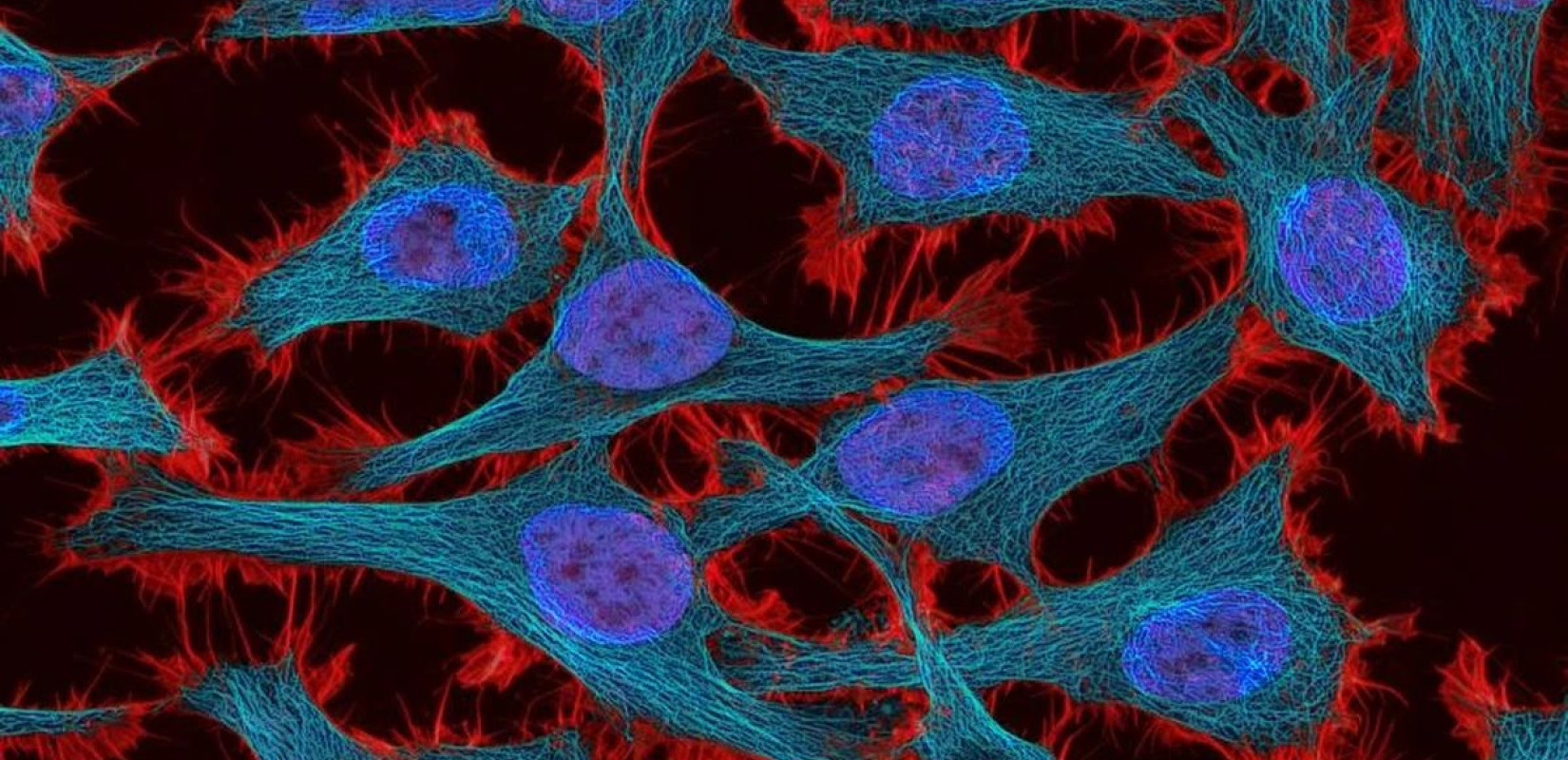 Τεχνητή Νοημοσύνη: Προβλέπει την ανταπόκριση του οργανισμού στη θεραπεία κατά του καρκίνου