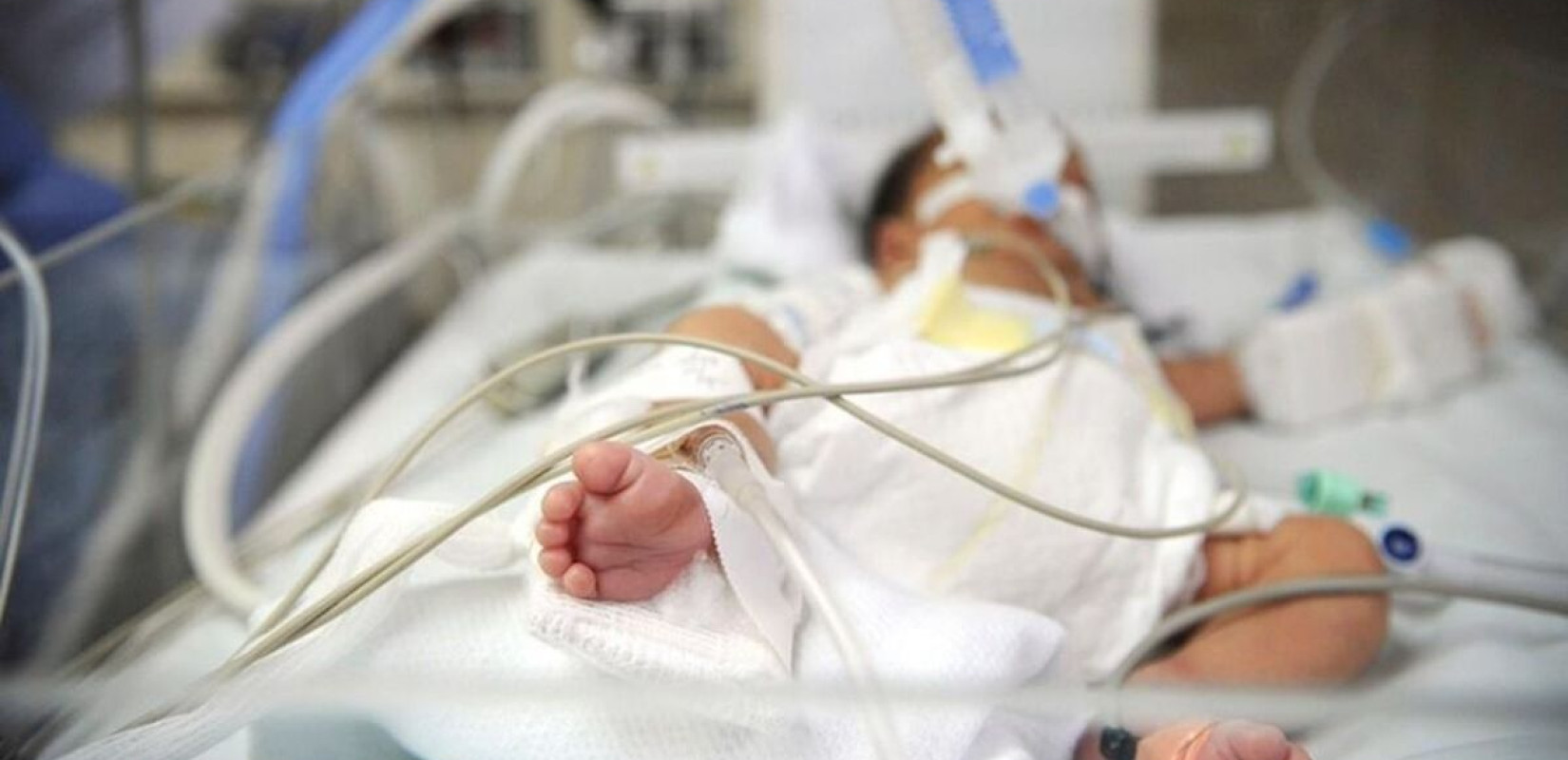 Αύξηση 57% της βρεφικής θνησιμότητας στα χρόνια της κρίσης στην Ελλάδα