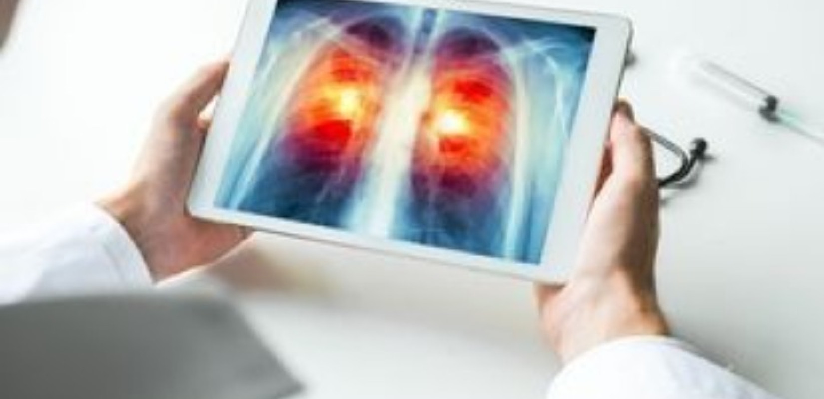 Μείωση της θνητότητας από καρκίνο πνεύμονα έως και 35% όπου εφαρμόζονται προγράμματα προσυμπτωματικού ελέγχου