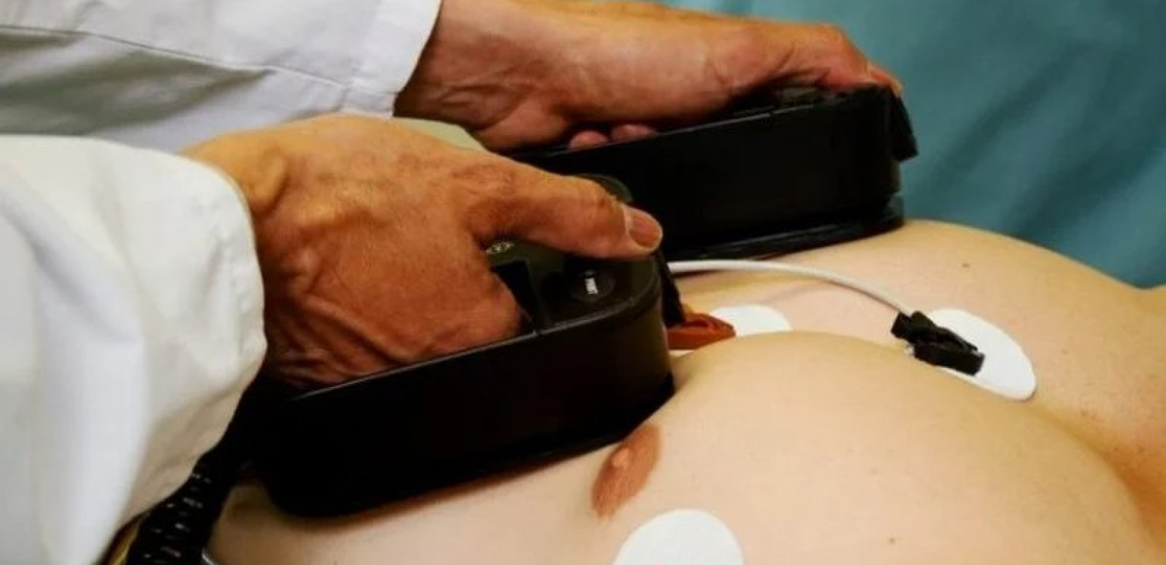 Θεσσαλονίκη: Έρχεται πρόγραμμα εκπαίδευσης στη βασική υποστήριξη ζωής και στη χρήση αυτόματου εξωτερικού απινιδωτή