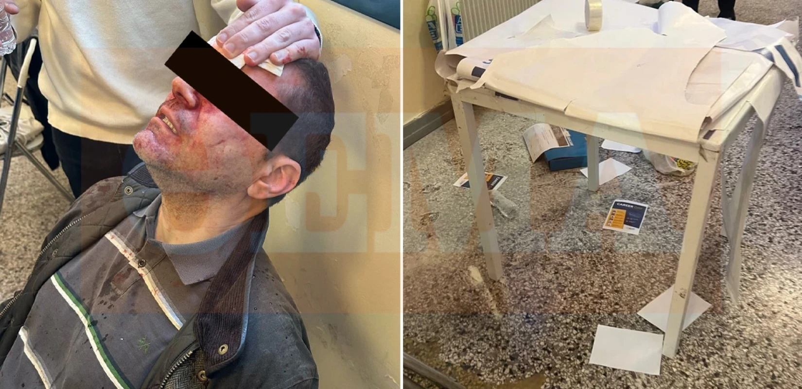 Επίθεση στη Νομική: «Σαρώνουν» τις κάμερες των παρακείμενων καταστημάτων οι Αρχές - Τα σενάρια για την προέλευση των δραστών (βίντεο)