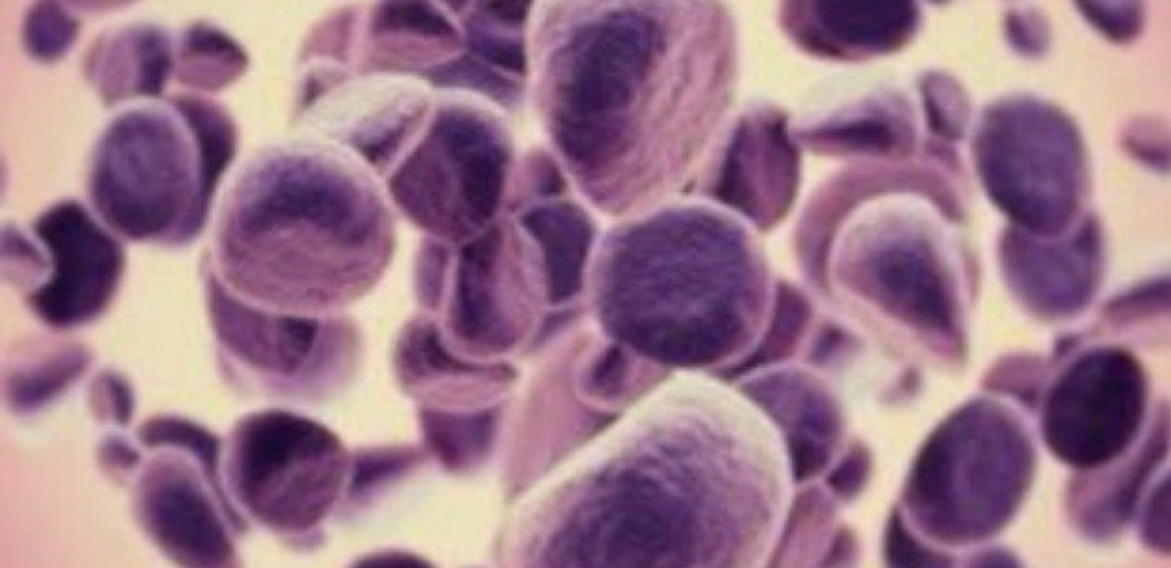 Καινοτόμος μέθοδος για απεικόνιση, διάγνωση και θεραπεία του καρκίνου με σφραγίδα Έλληνα καθηγητή