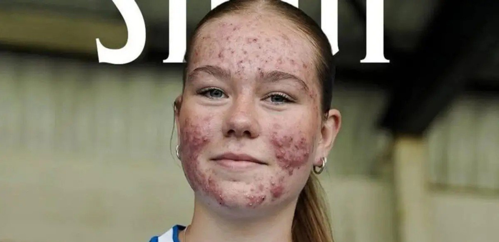 Σκωτία: Η Στουτ σκόραρε στο ντεμπούτο της και έδωσε την καλύτερη απάντηση στον σεξισμό (βίντεο)