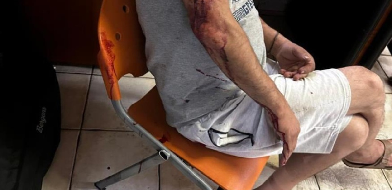 Καταγγελία ΚΕΕΡΦΑ: Ρατσιστική επίθεση με σιδηρολοστό κατά μετανάστη που ζήτησε τα δεδουλευμένα του στον Ασπρόπυργο - «Να πας στη χώρα σου»