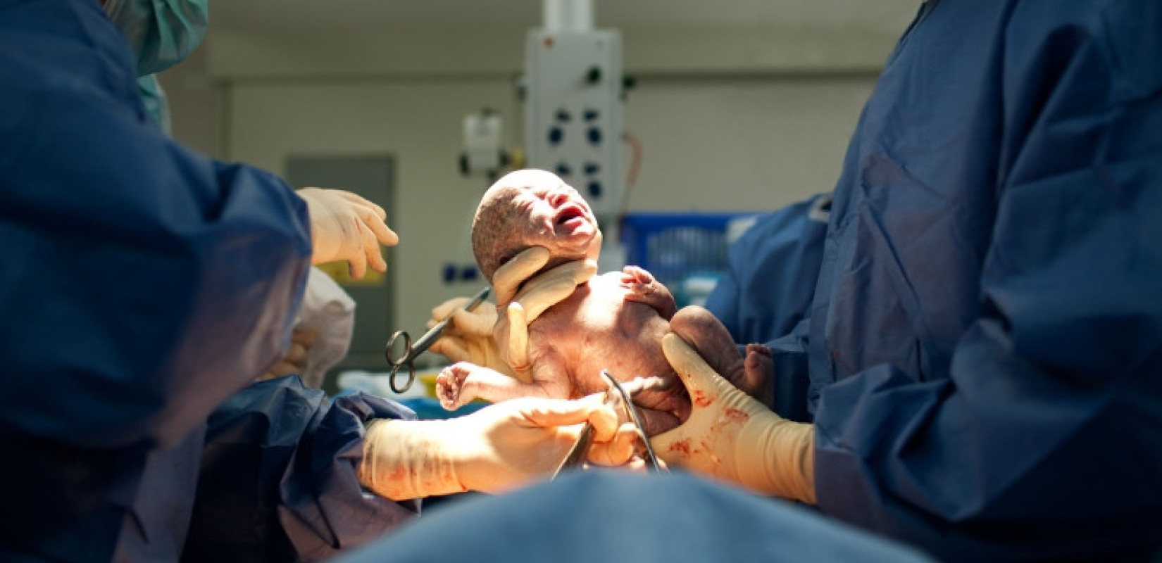 «Έκρηξη» στις καισαρικές: Γιατί η Ελλάδα «σπάει τα ρεκόρ» στην Ευρώπη