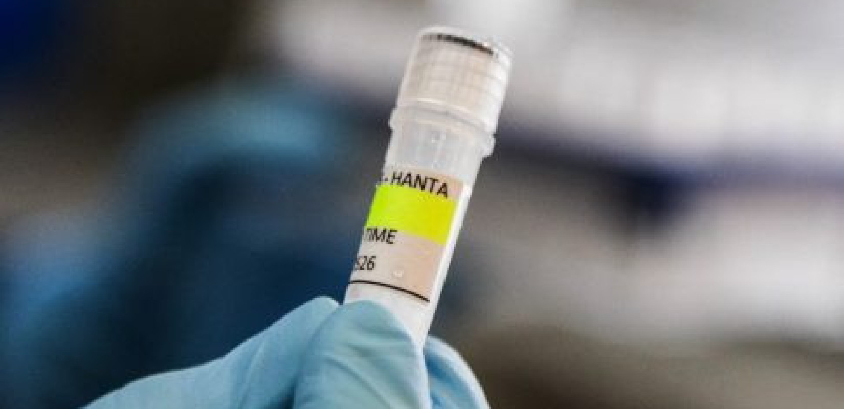 Ιταλία: Το υπουργείο υγείας ενεργοποίησε διαδικασία επιτήρησης για τέσσερις επιβάτες πτήσης που ήρθαν σε επαφή με γυναίκα που πέθανε από Χανταϊό
