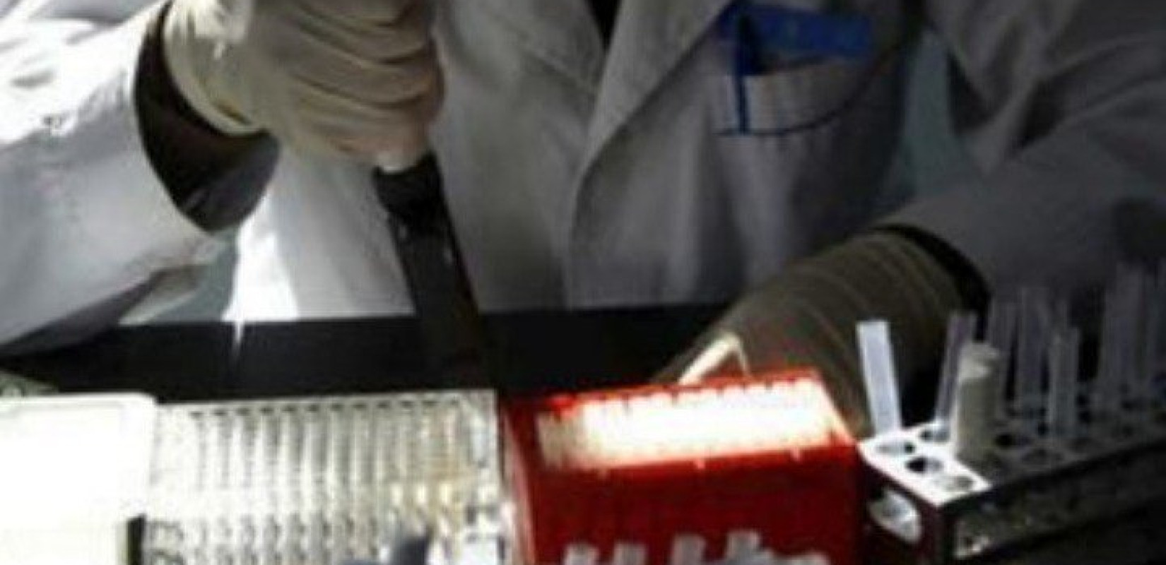 Ελληνική Μικροβιολογική Εταιρεία: Η απόφαση του ΕΟΠΥΥ για είσπραξη του clawback οδηγεί τα εργαστήρια στο κλείσιμο