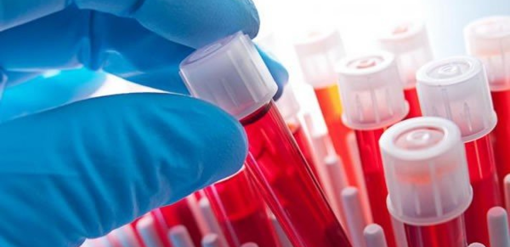 Θεσσαλονίκη: Ποια είναι τα 25 Κέντρα Υγείας που θα πραγματοποιούνται χωρίς ραντεβού οι αιματολογικές εξετάσεις