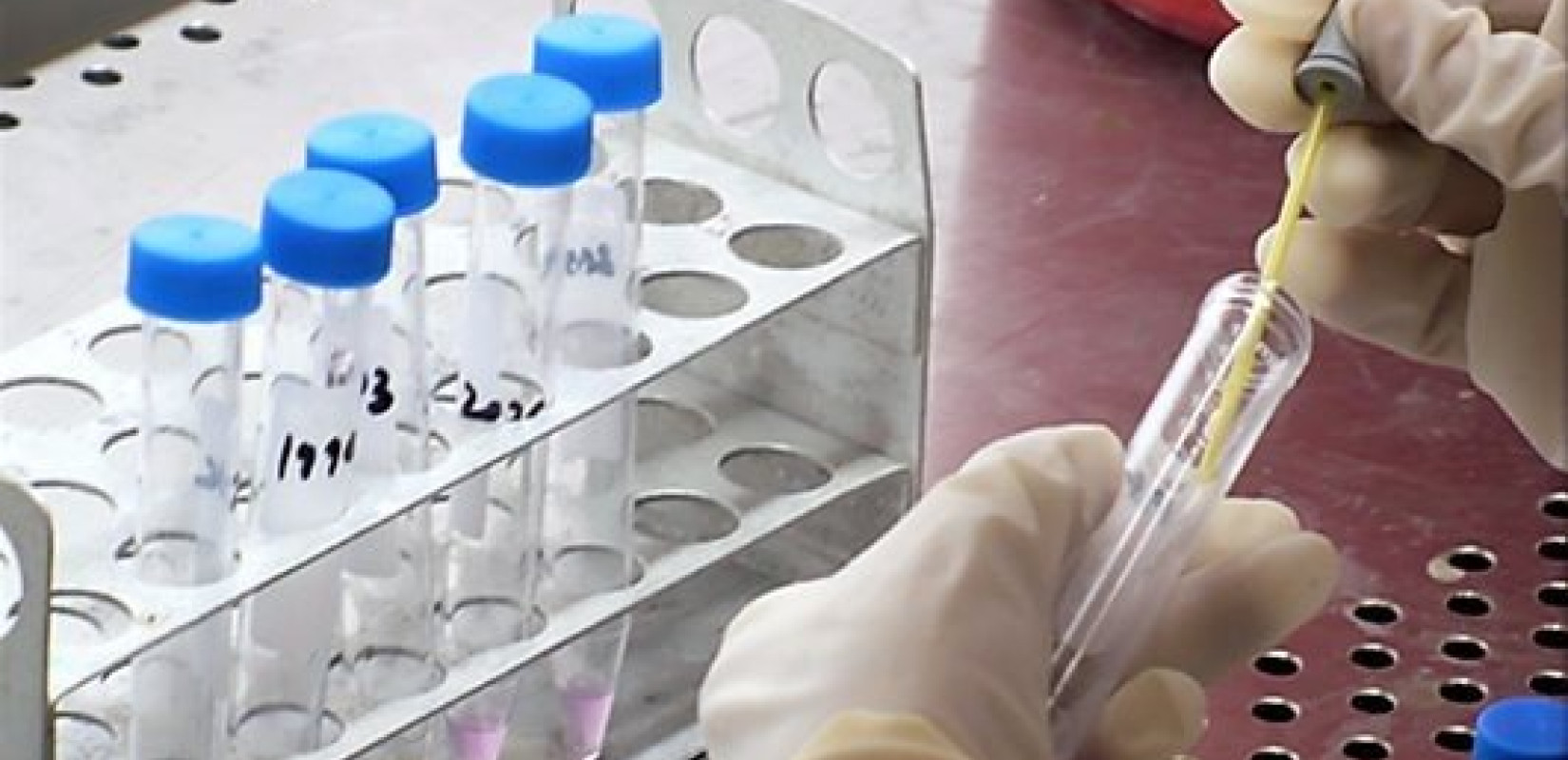 Κατάργηση του claw back ζητούν οι Φορείς Πρωτοβάθμιας Φροντίδας Υγείας