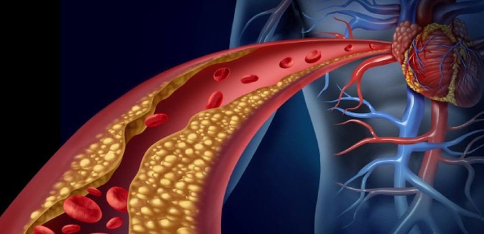Χοληστερόλη: Οι τιμές που απειλούν τη μνήμη και αυξάνουν τον κίνδυνο άνοιας