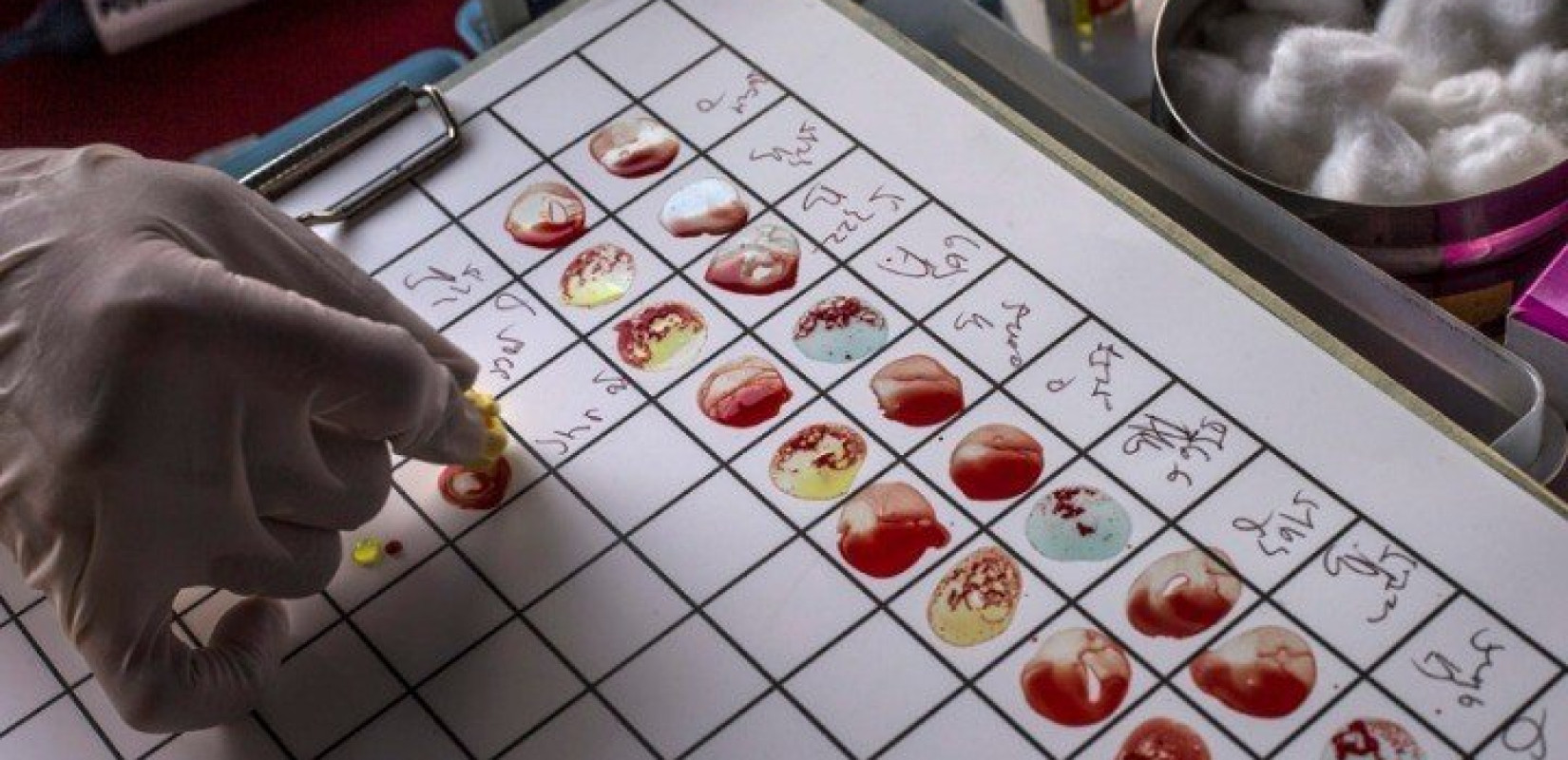 Πειραματικό τεστ αίματος ανιχνεύει το DNA από οκτώ διαφορετικά είδη καρκίνου